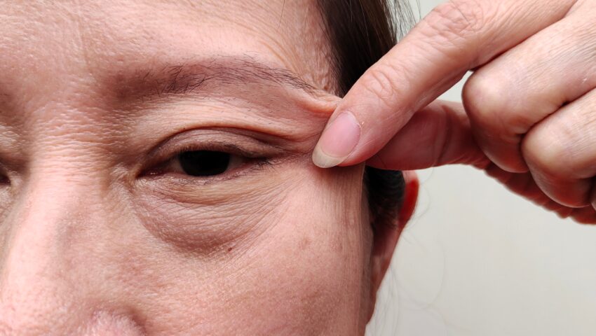 You are currently viewing Sagging Skin Isn’t Just a Skin Problem