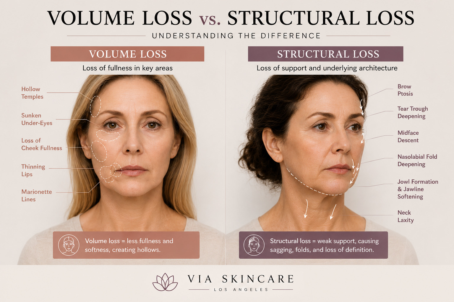 You are currently viewing Your Face Isn’t Losing Volume — It’s Losing Its Architecture